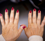 טיפולים חדשים באוסטאופורוזיס-תמונה